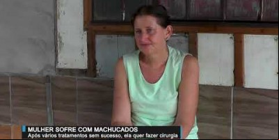 Após sofrer 28 anos com feridas nos tornozelo, mulher quase não consegue mais andar